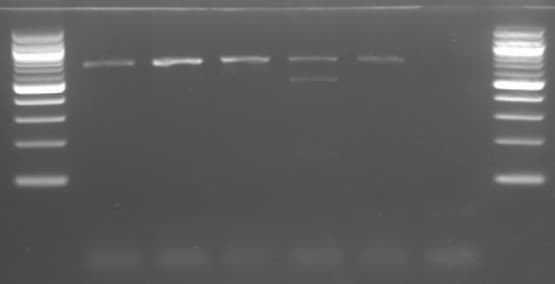 Some of the genotyping results showing the gene of interest, compared to known gene sequences and to a molecular-weight size marker (DNA ladder on the left and right ends).