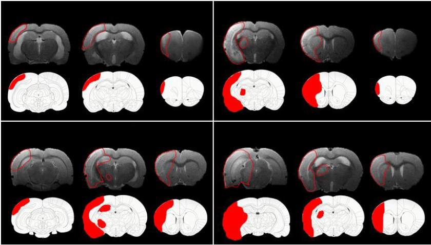 T2-weighted MRI images, 7 days post-stroke, alongside diagrams of corresponding coronal slices. The infarct area, observed via light microscopic examination of H&E-stained sections, was manually drawn onto the diagrams and is showcased in red.