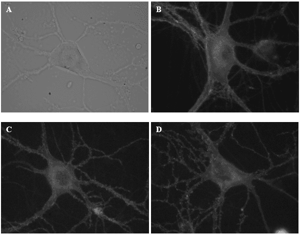These are some of the neurons from which I recorded electrical activity today. Image (A) illustrates a neuron under a DIC microscope. Images B-D display neurons labelled with a fluorescent reporter.