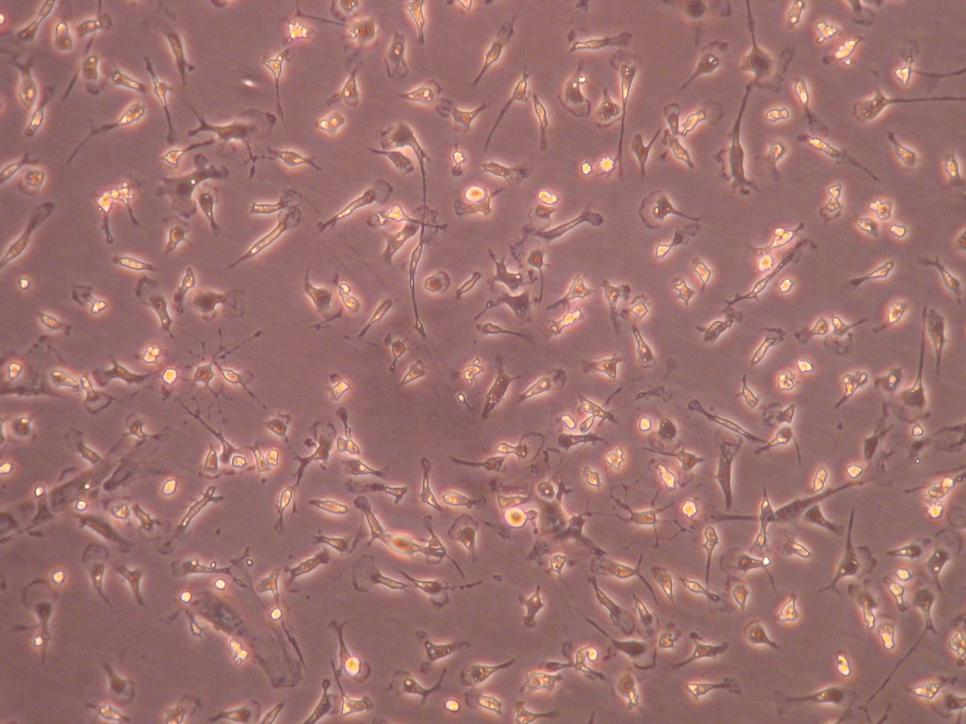 Intricately cultured microglia, extracted from a mixed glia culture of cells originally dissected out of neonatal brains.